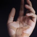 Hand held up with plaster, against black background